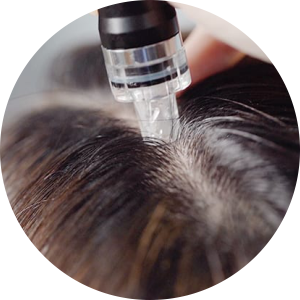 Best Clinic for Hair fall Treatments in Adajan, Surat
