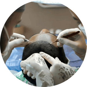 Best Clinic for Hair fall Treatments in Adajan, Surat