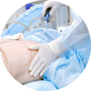 Best Clinic for Body Makeover Treatments in Adajan, surat