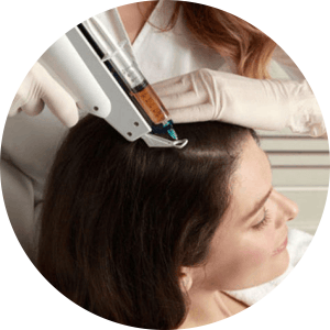 Best Clinic for Hair fall Treatments in Adajan, Surat