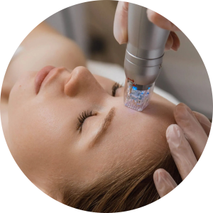 Best Clinic for Ance and Acne Scar Treatments in Adajan