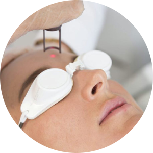 Best Clinic for Ance and Acne Scar Treatments in Adajan