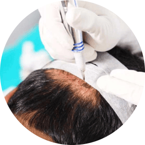 Best Clinic for Permanent Makeup in Adajan, Surat (PMU)