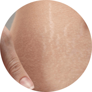 Best Clinic for Body Makeover Treatments in Adajan, surat