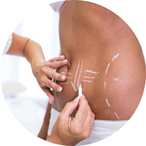 Best Clinic for Body Makeover Treatments in Adajan, surat