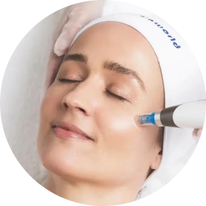 Best Clinic for Ance and Acne Scar Treatments in Adajan