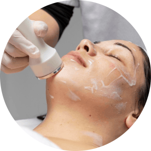 Best Clinic for Skin Glow Treatment in Adajan, Surat